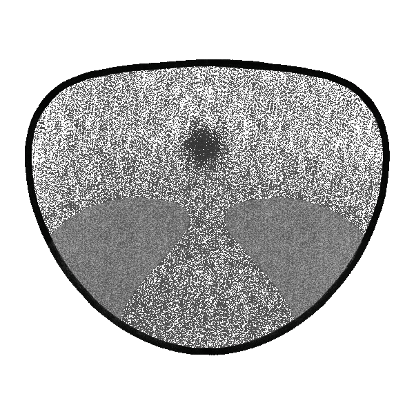 Solar Multifocal